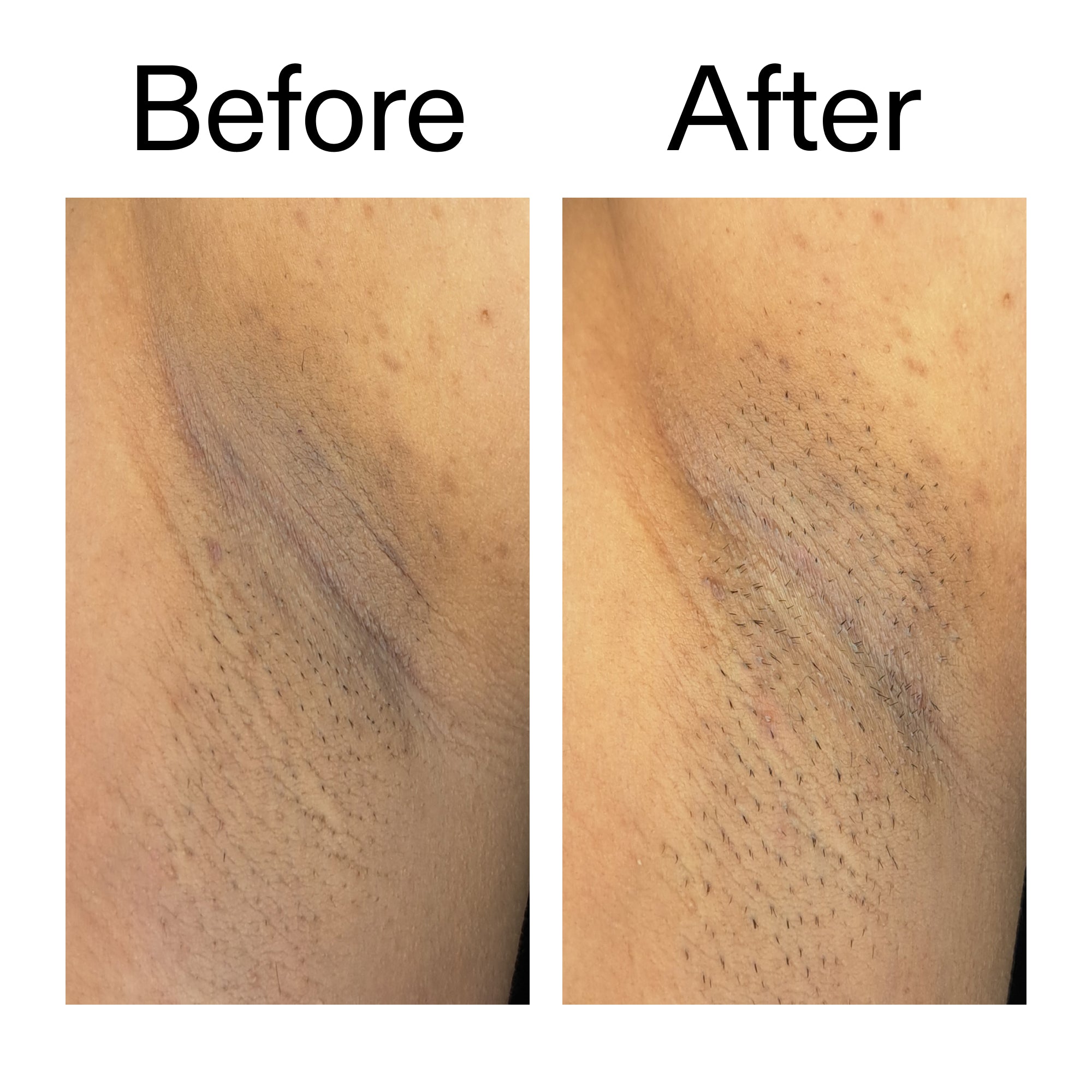Glycolic Acid Exfoliating Body Stick - Image 11