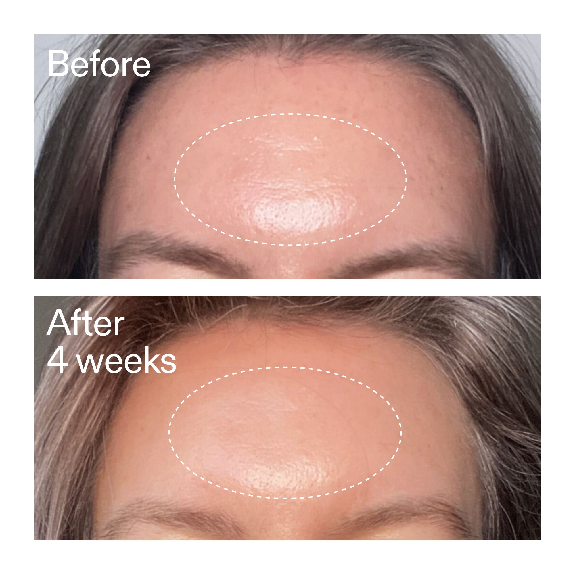 Advanced 0.2% Retinal Serum Duo - Image 12