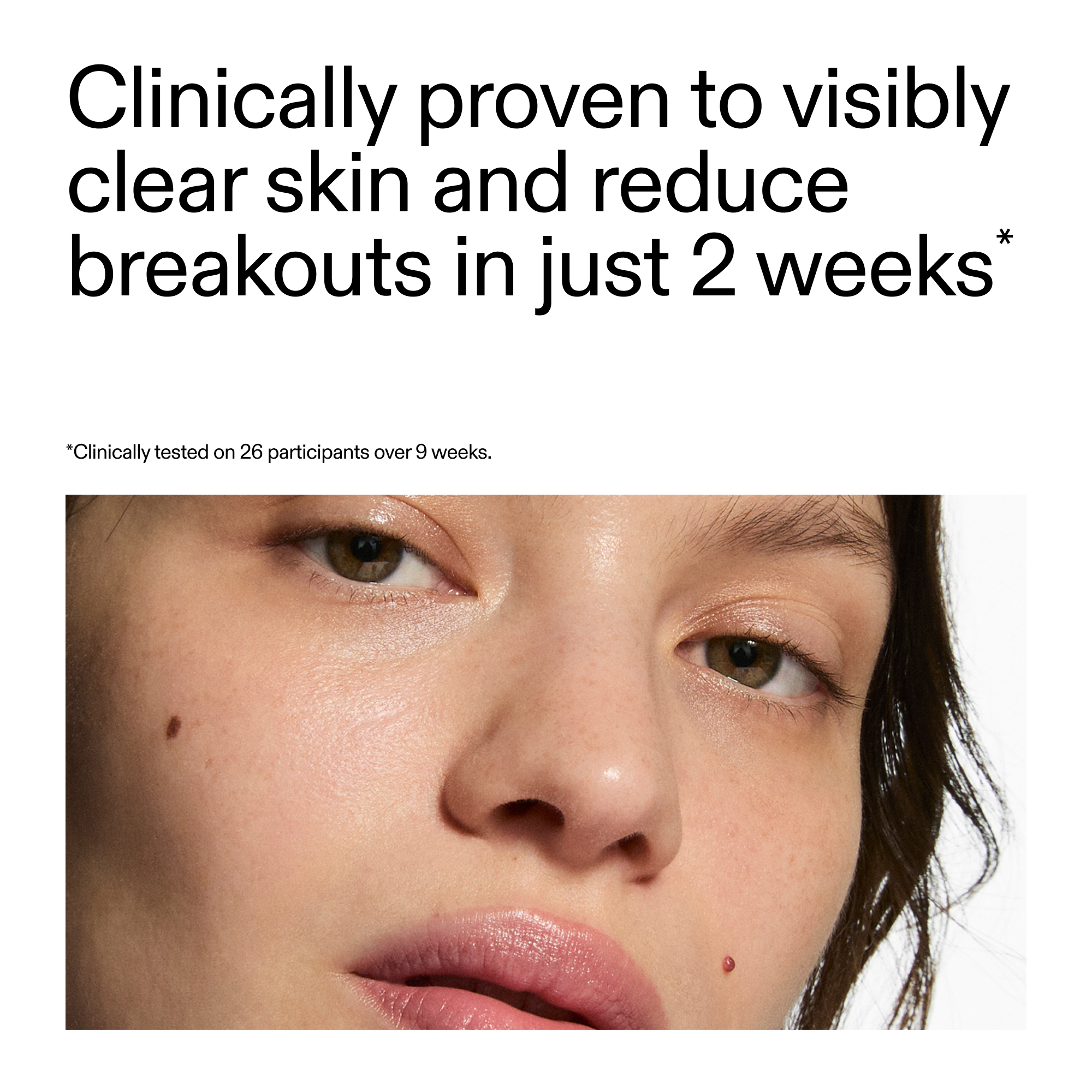 360° Acne Clearing Duo - Image 7