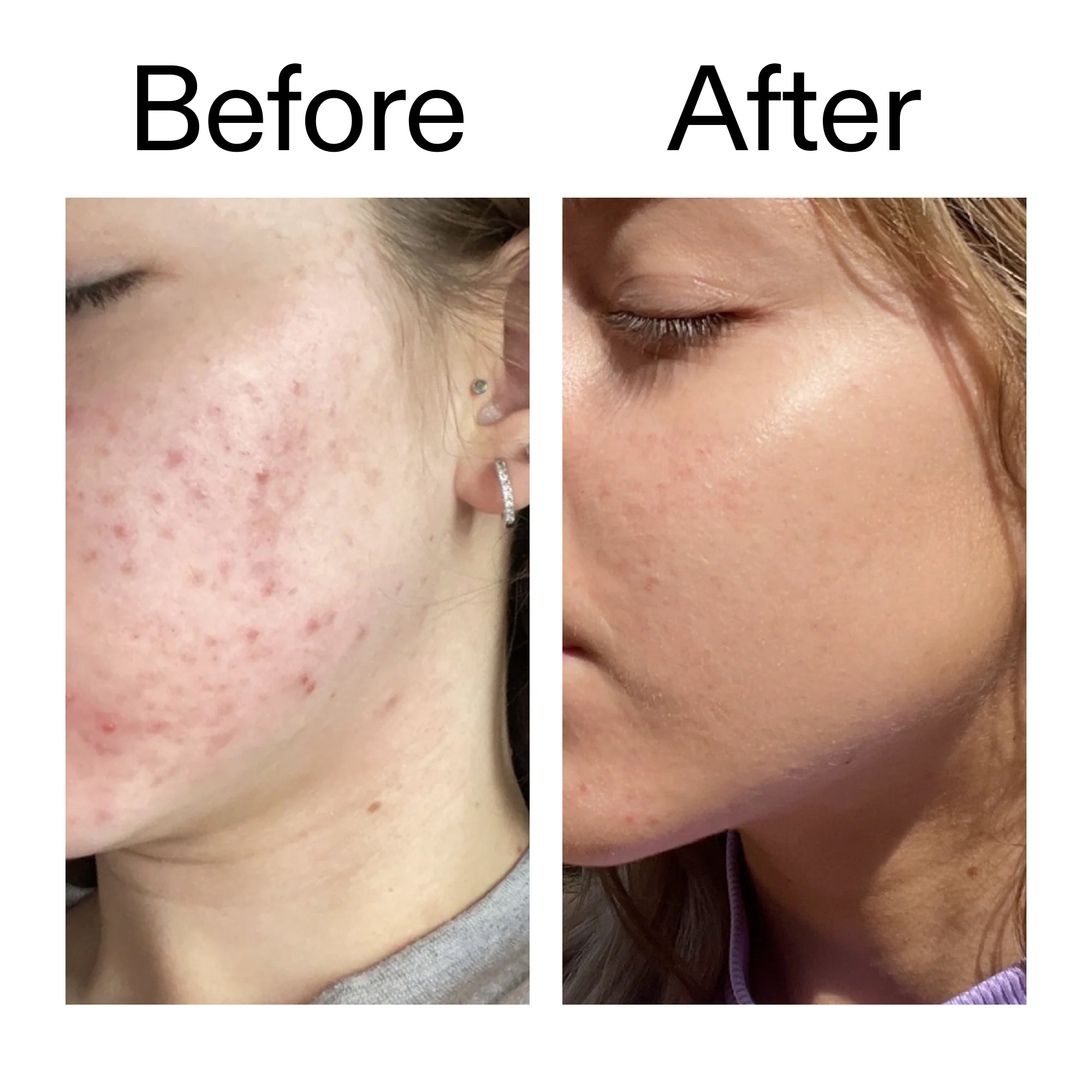 10% Niacinamide Serum Duo - Image 9