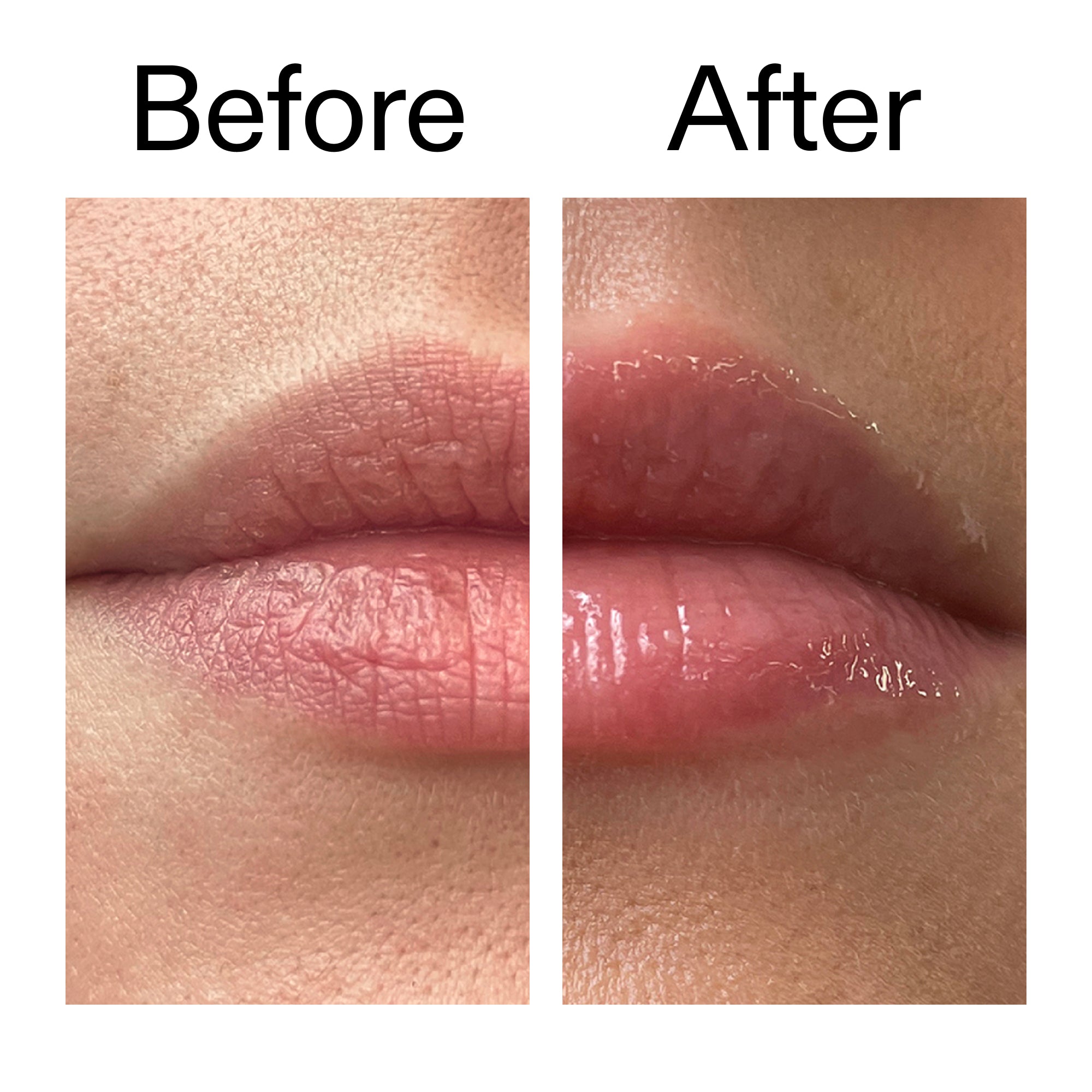 Lip Plumping Duo - Image 9