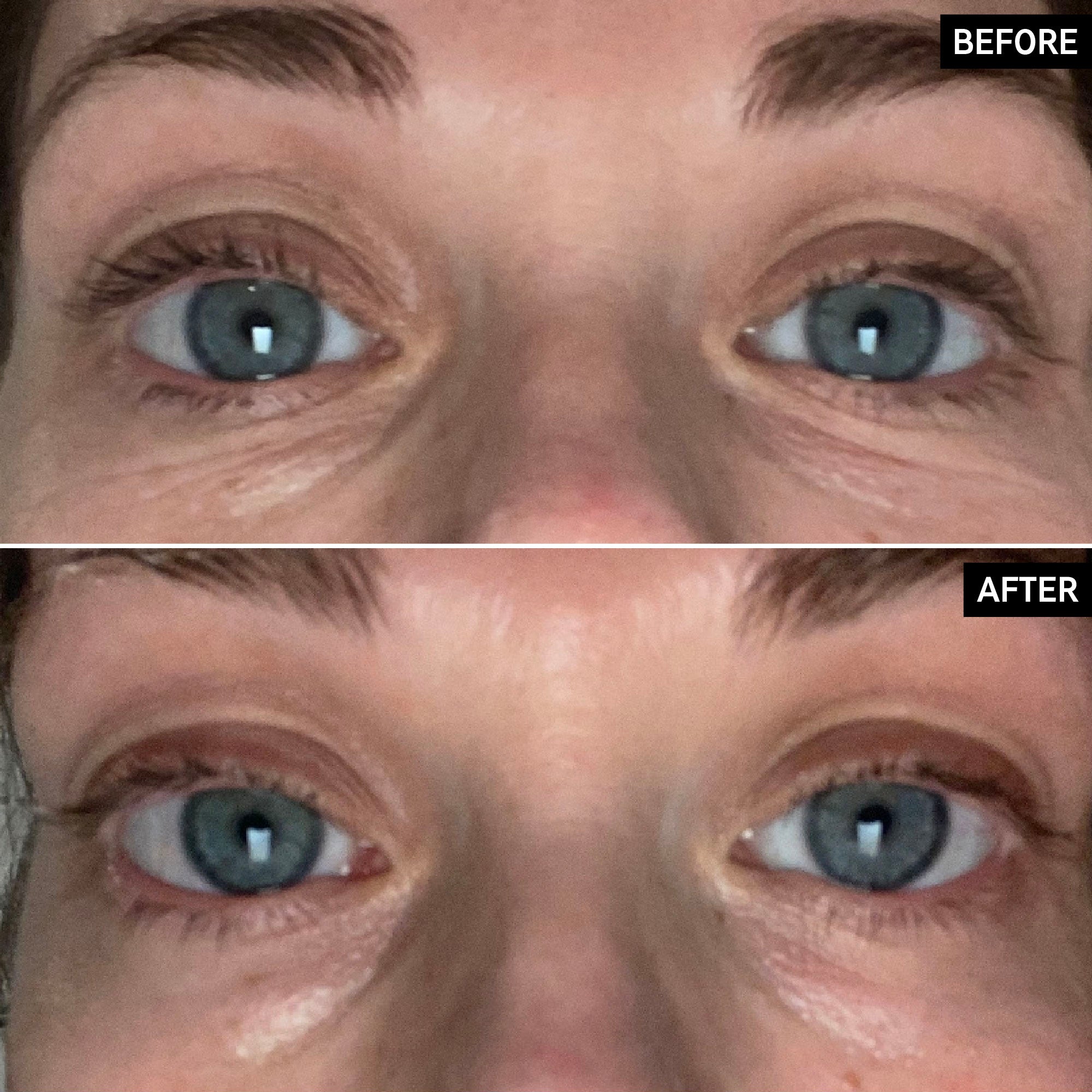 Retinol Eye Cream - Image 10