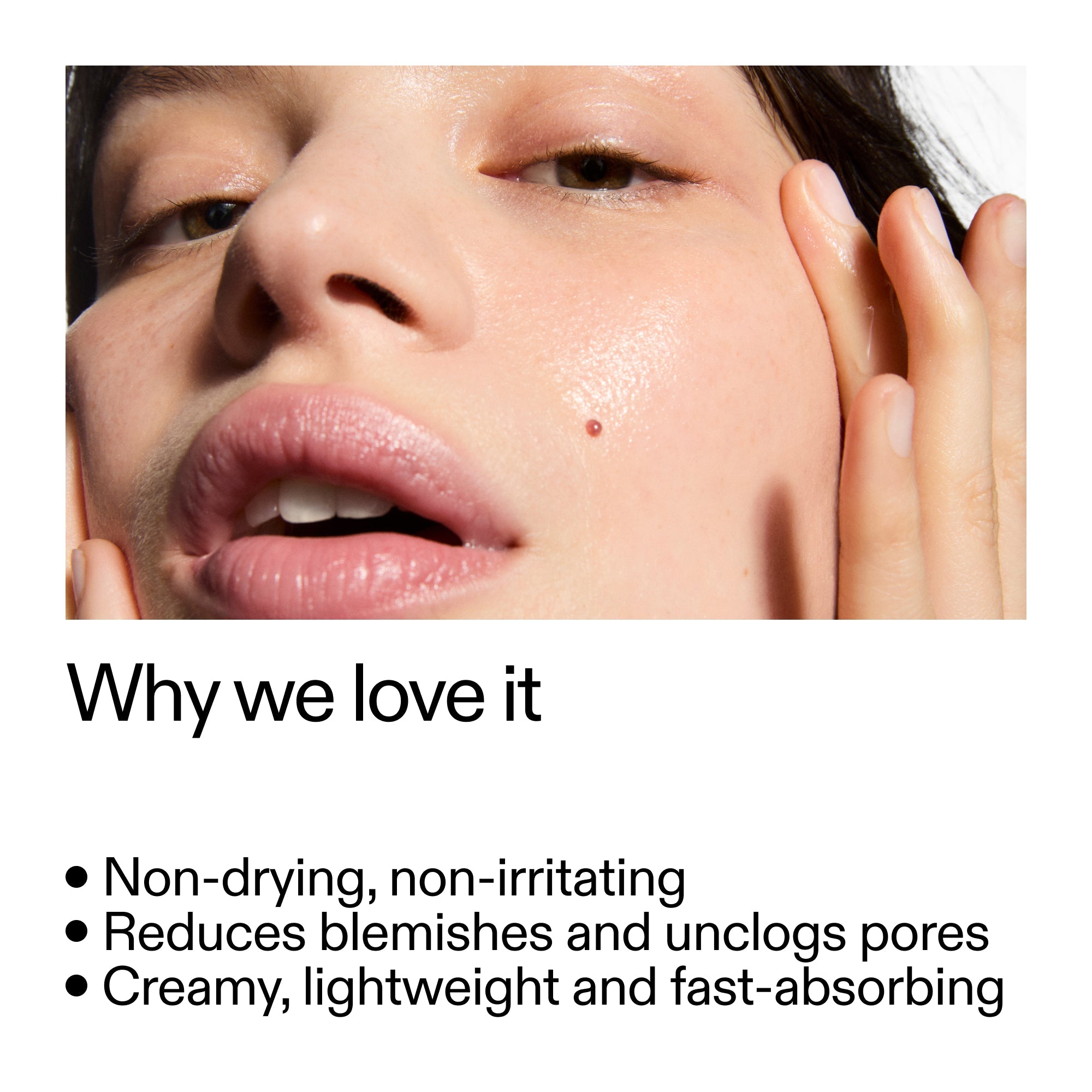Succinic Acid Acne Treatment - Image 4
