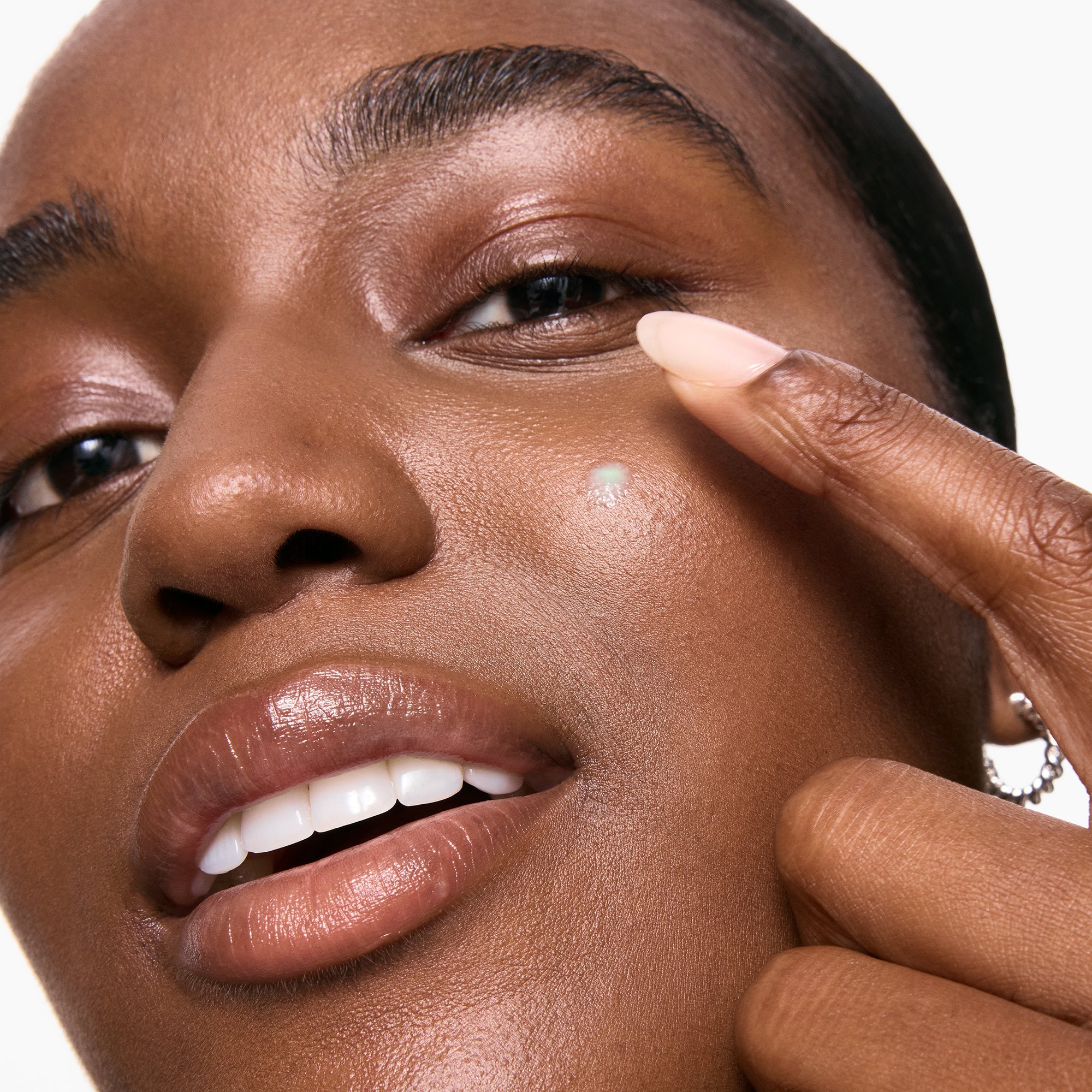 Succinic Acid Acne Treatment - Image 12