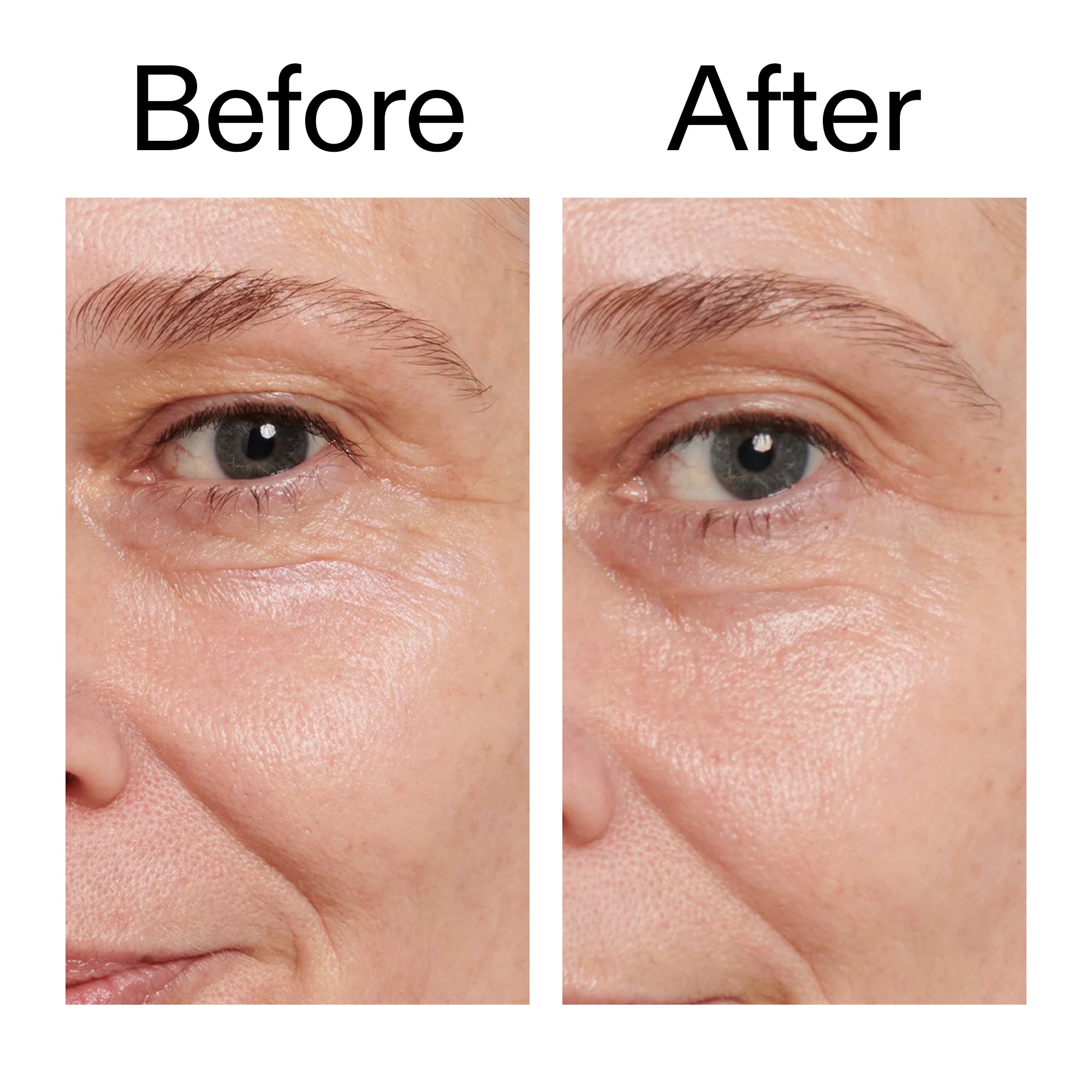 Retinol Eye Cream - Image 9