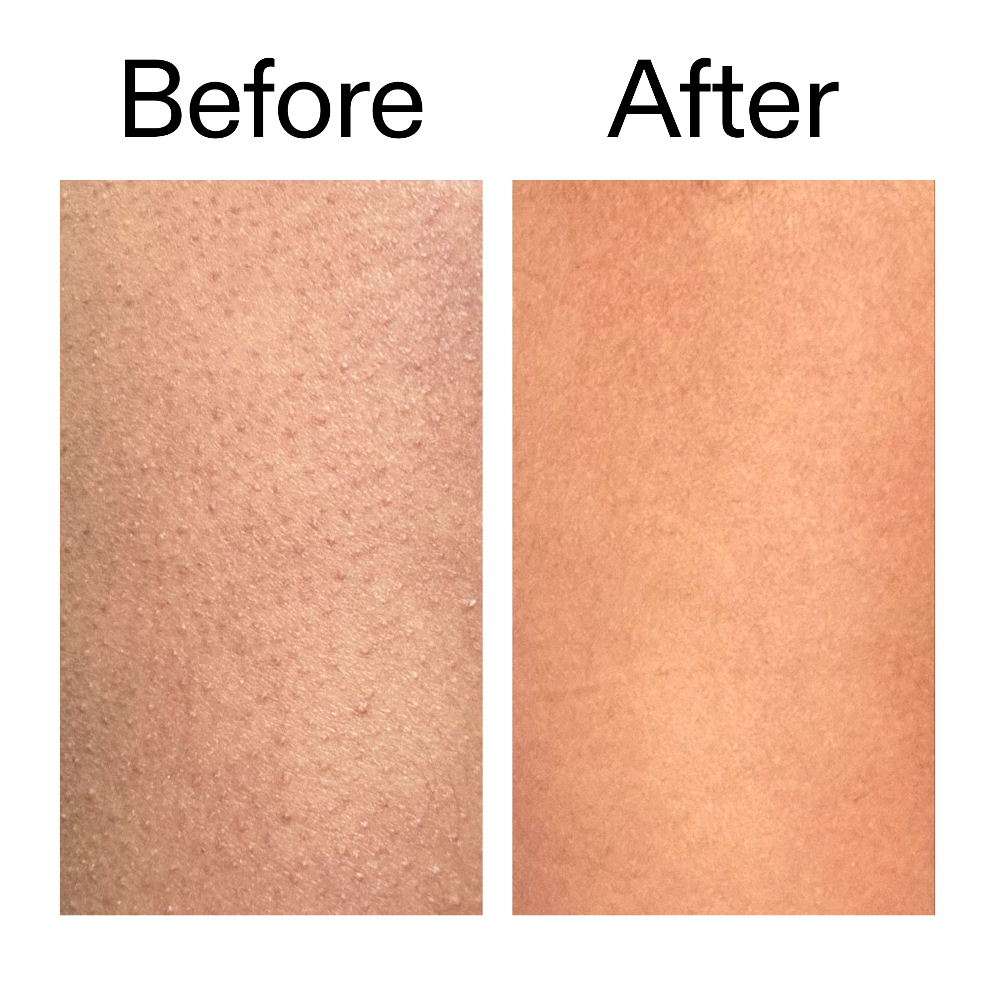 Glycolic Acid Exfoliating Body Stick - Image 14