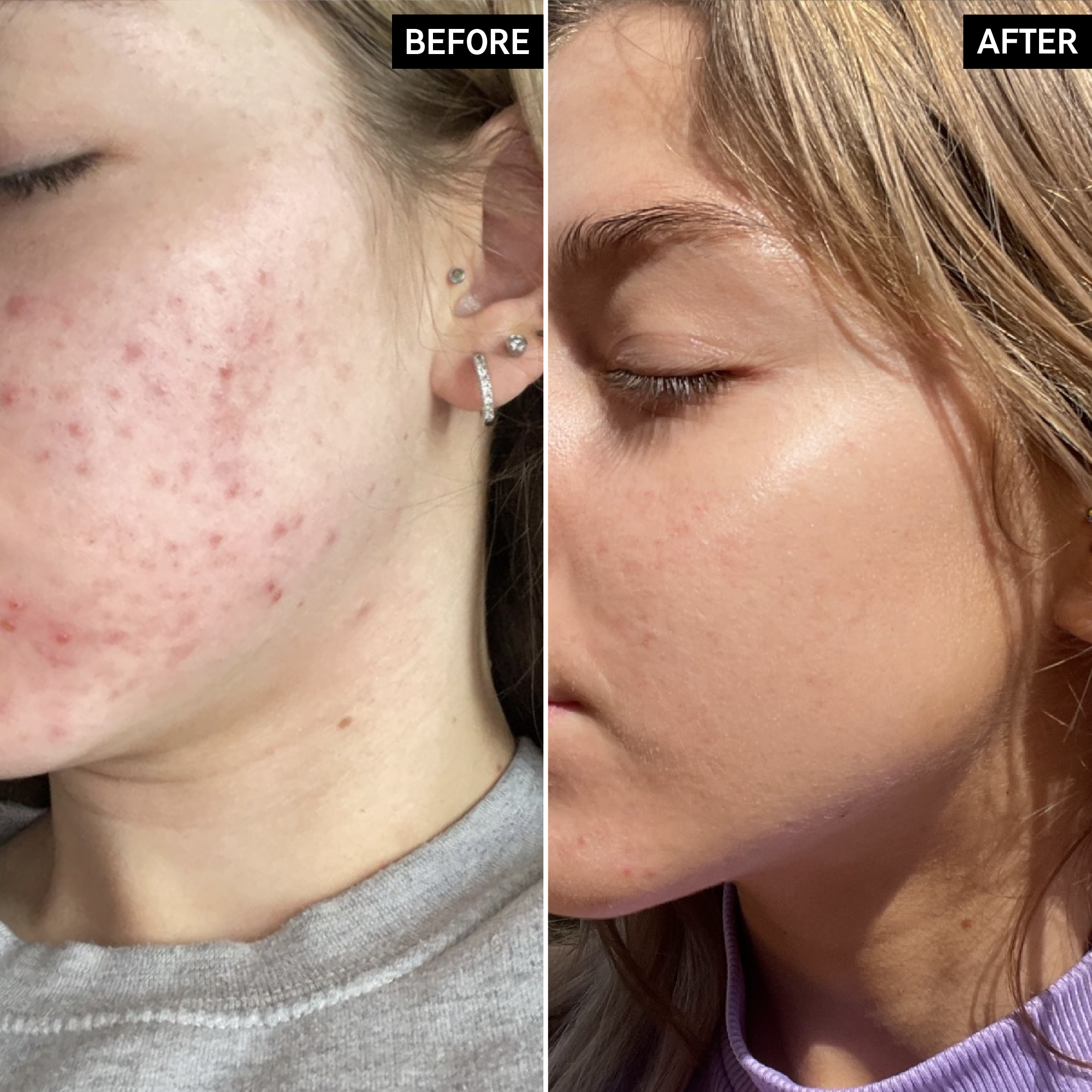 Deep Cleanse Duo - Image 6