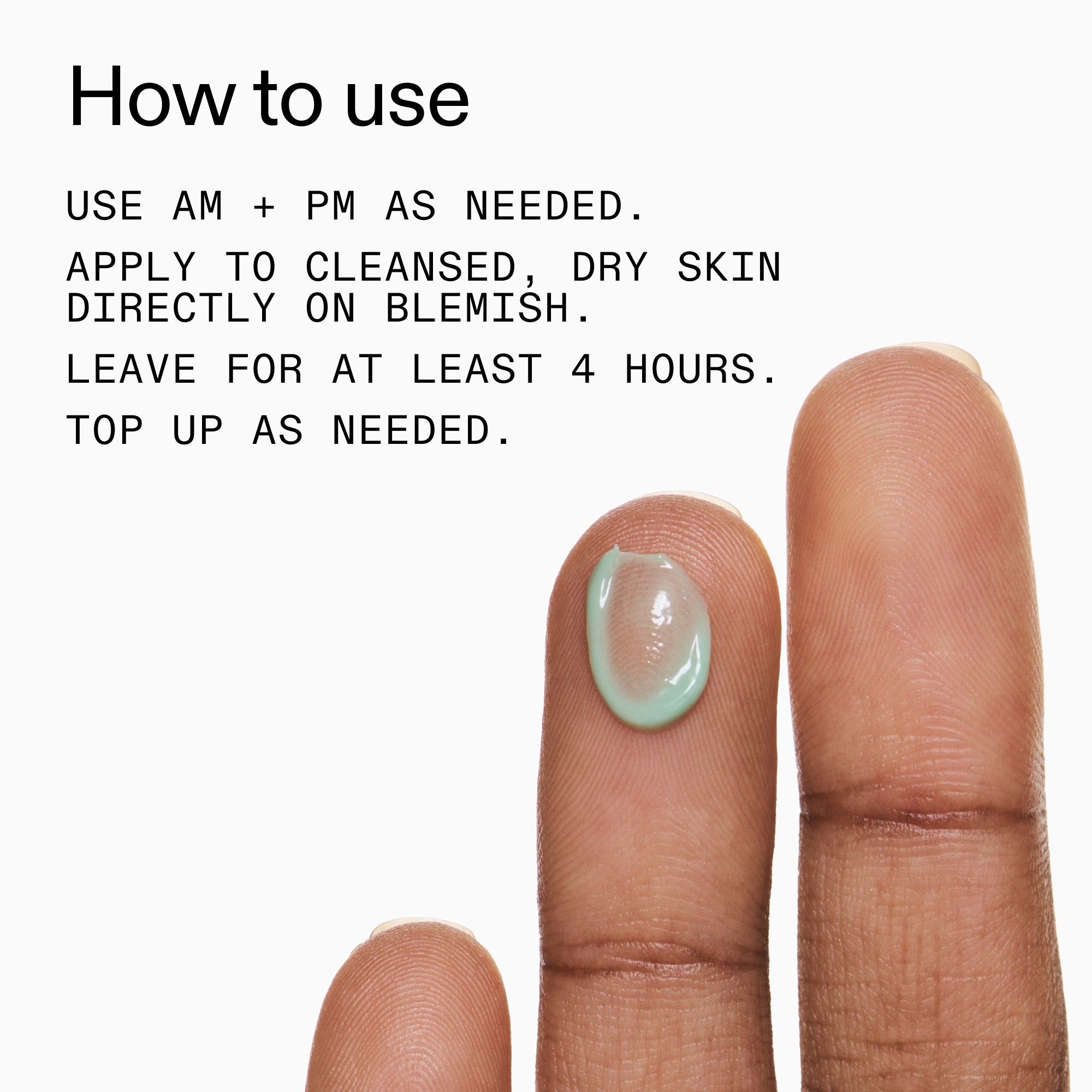 Succinic Acid Acne Treatment - Image 8