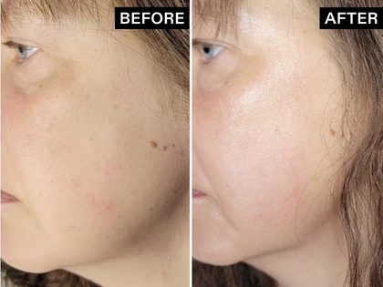 Before and after comparison