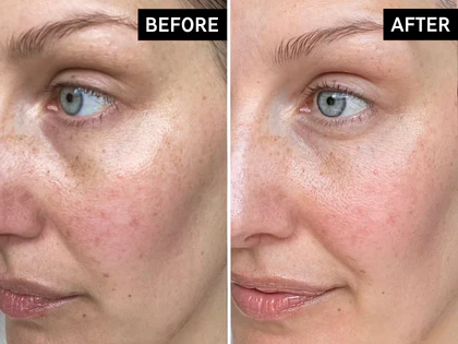 Before and after comparison