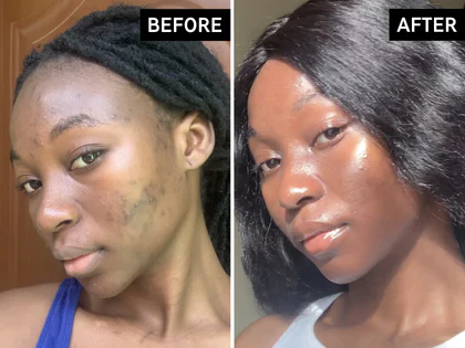 Before and after comparison