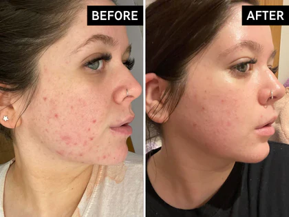 Before and after comparison