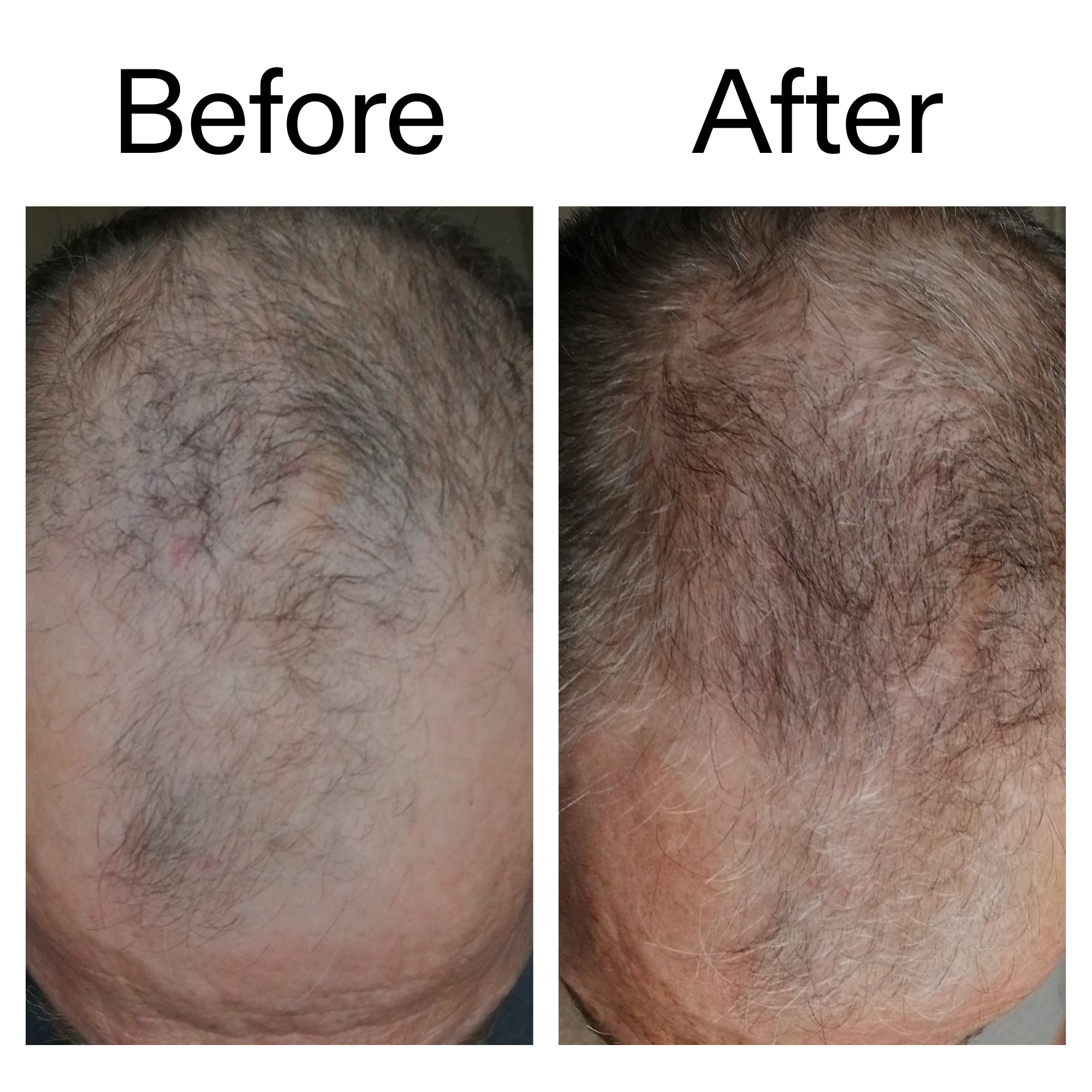 Caffeine stimulating scalp treatment - Image 7