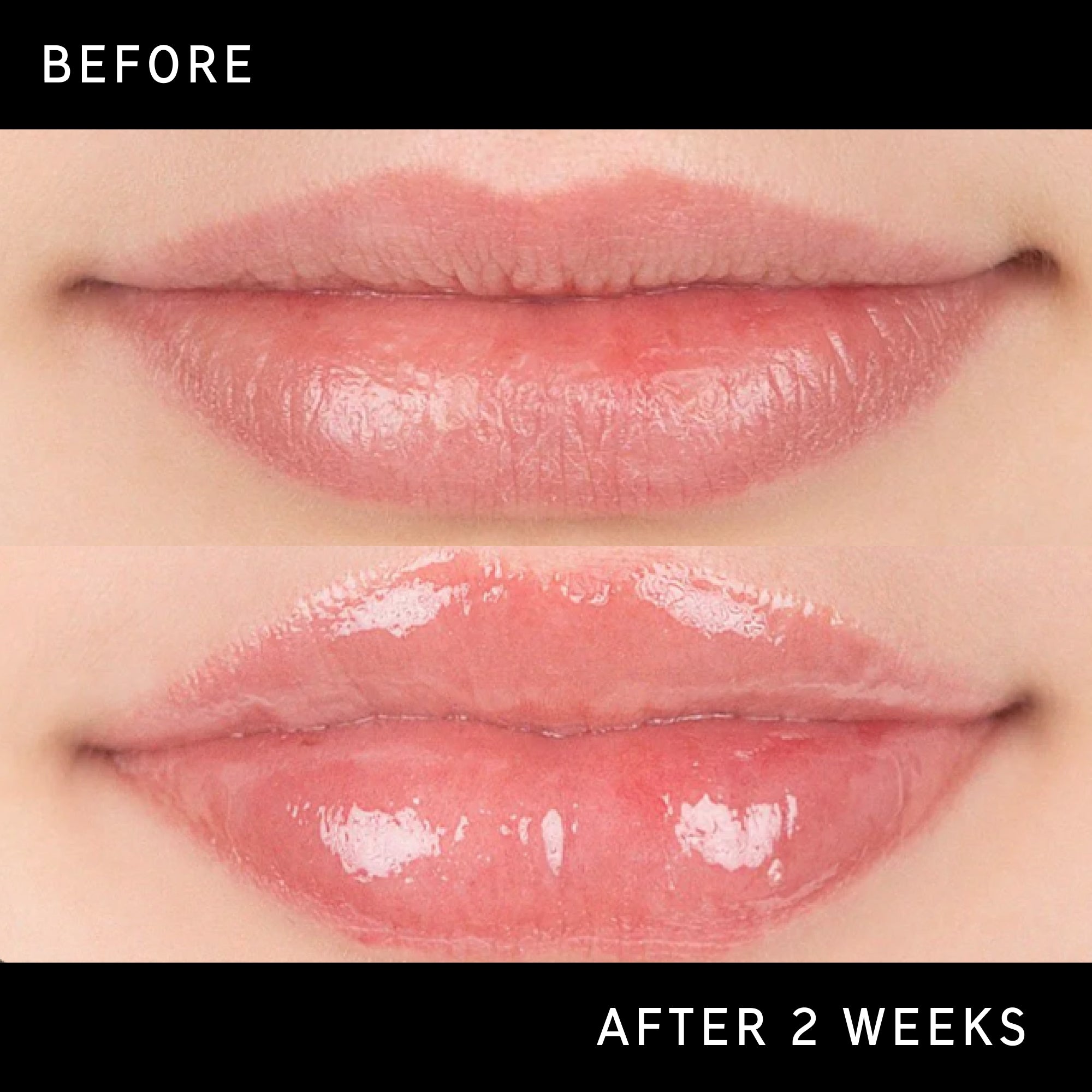 Lip Plumping Duo - Image 12