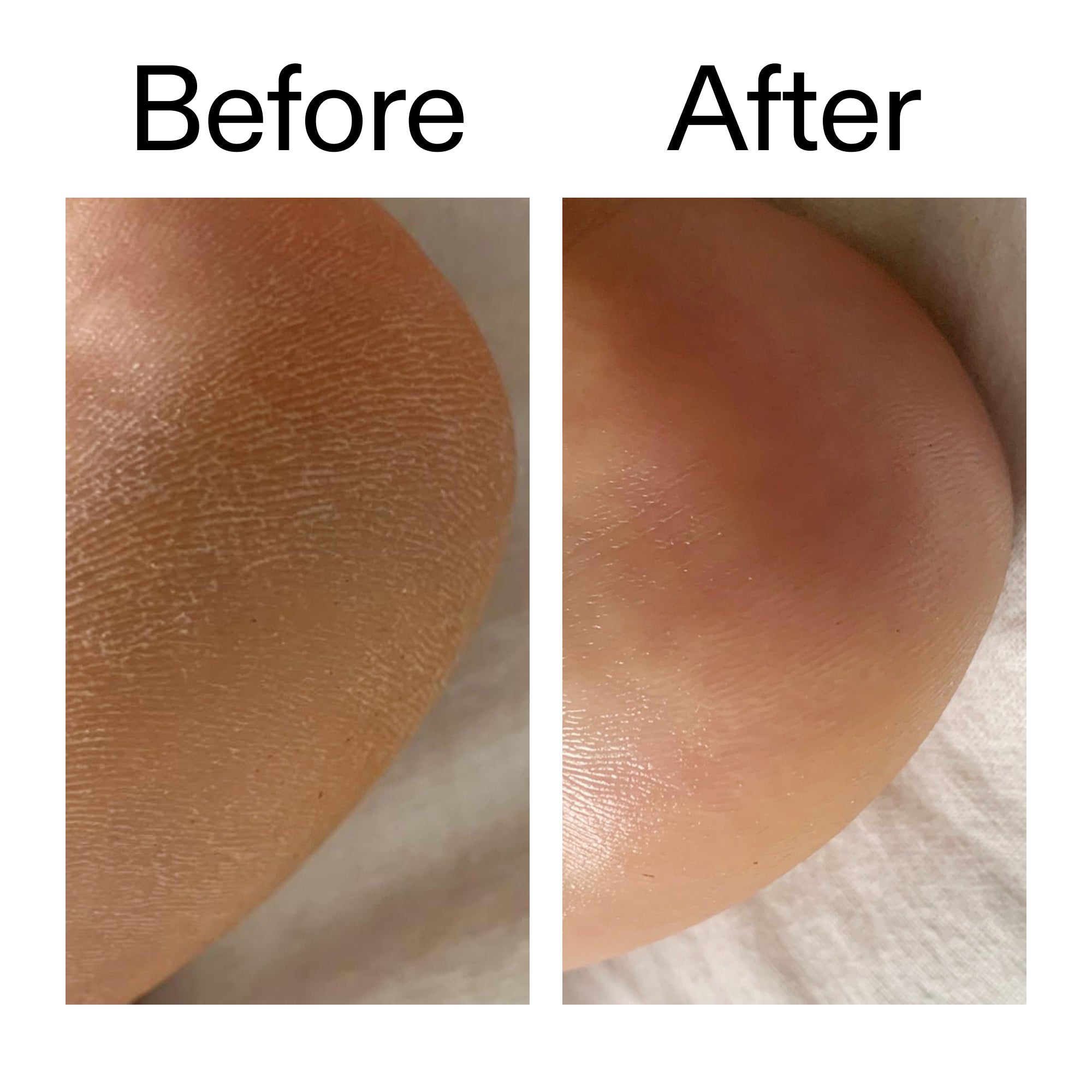 Glycolic Acid Exfoliating Body Stick - Image 13