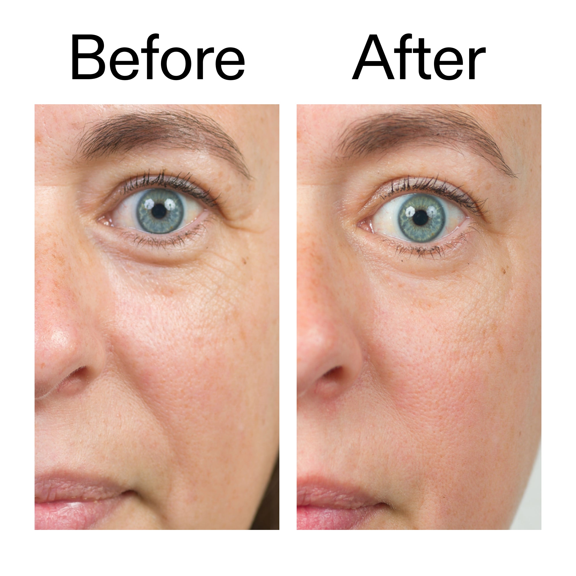 Bio-Active Ceramide Moisturizer Duo - Image 10