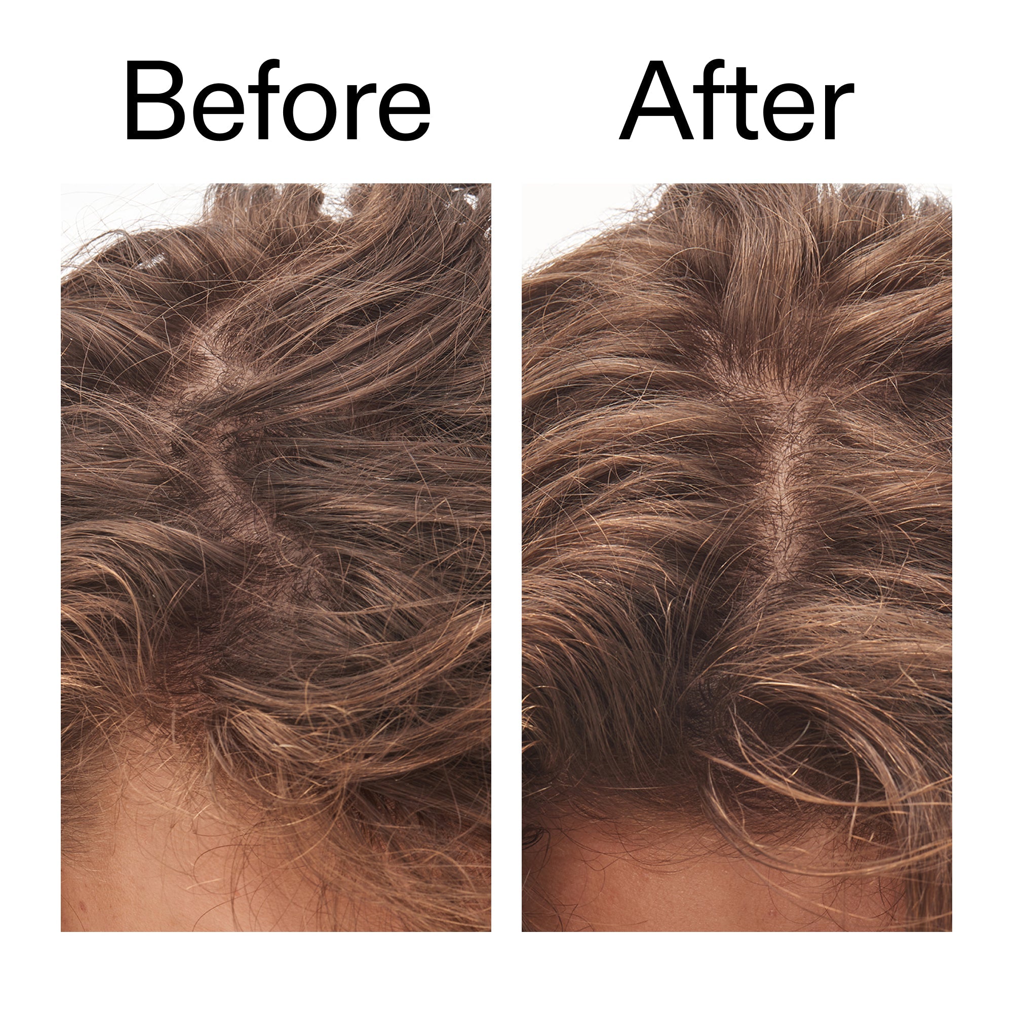 Glycolic Acid Exfoliating Scalp Scrub - Image 10