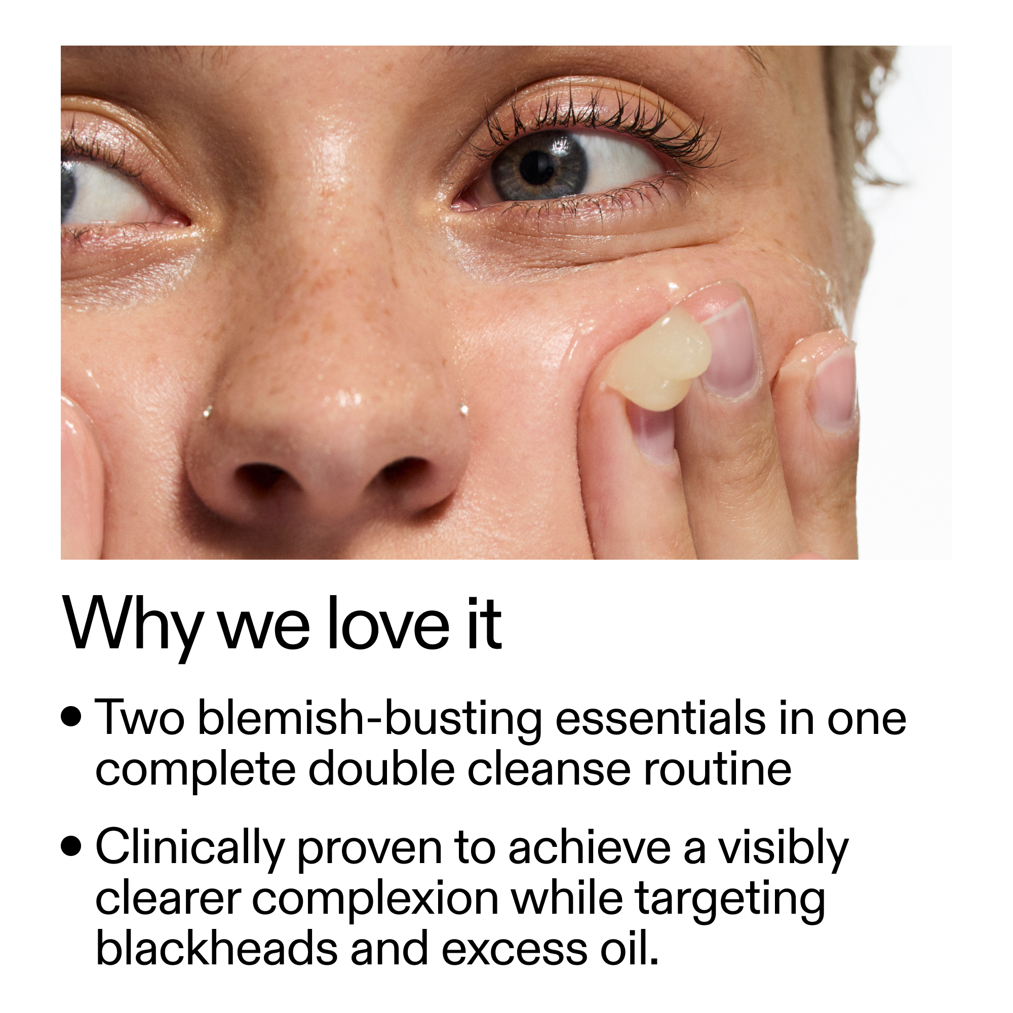 Acne Double Cleanse Duo - Image 3