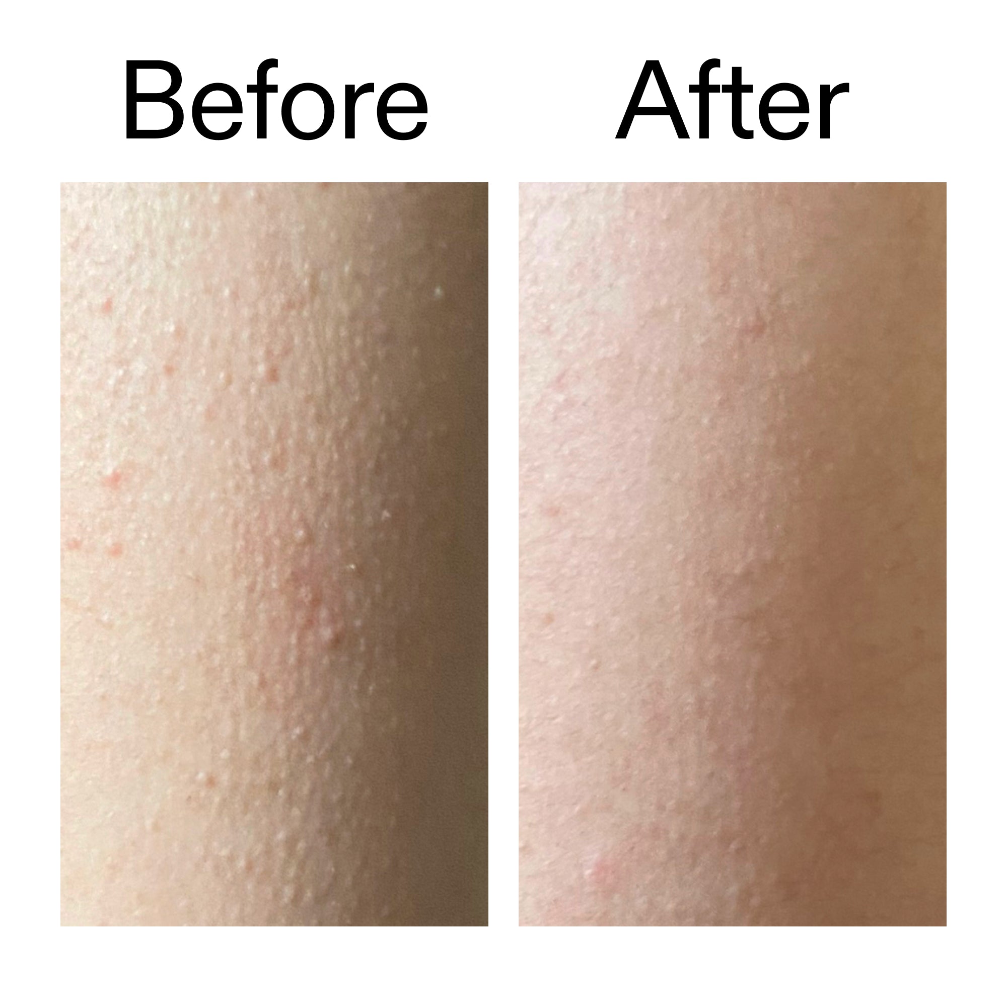 Glycolic Acid Exfoliating Body Stick - Image 9
