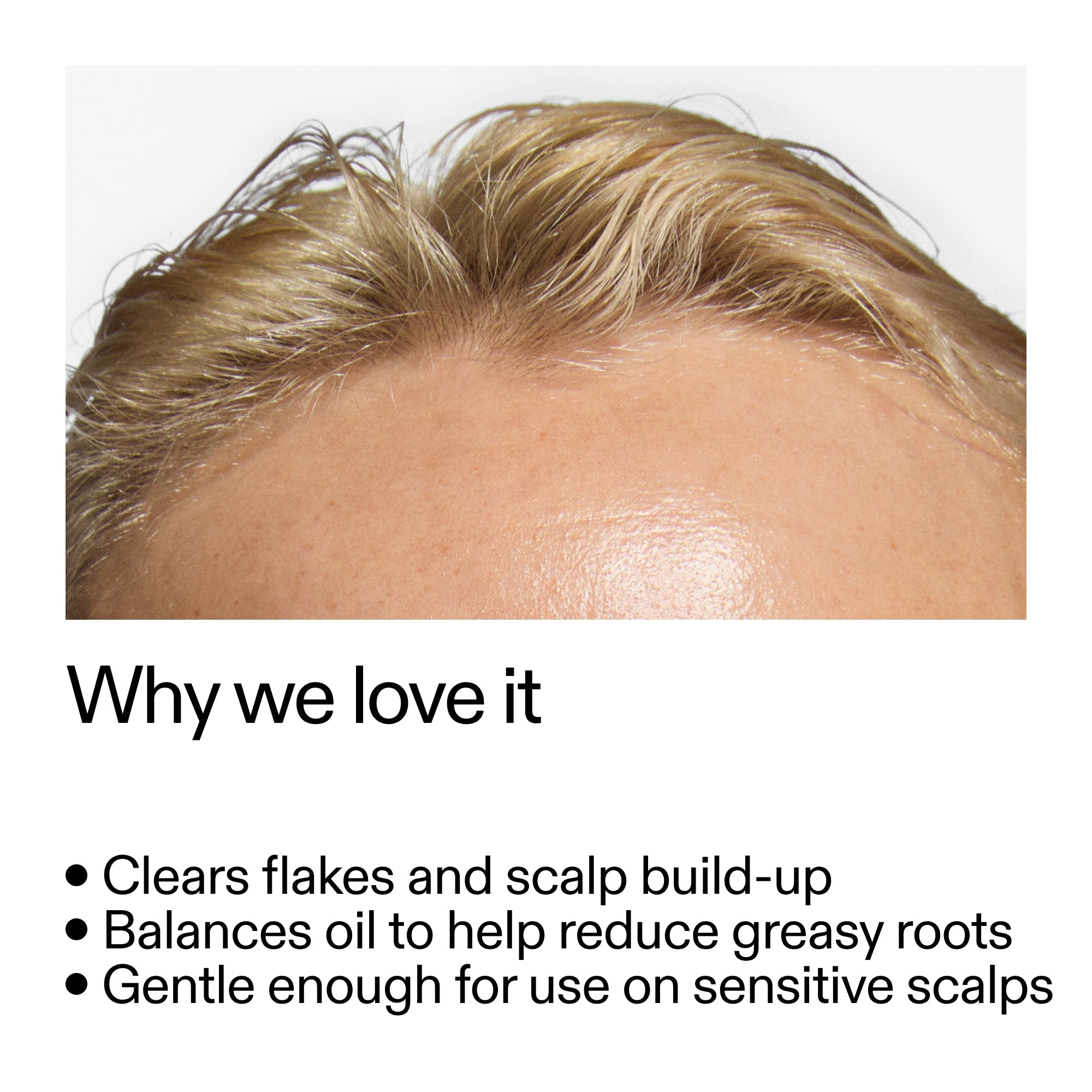 Salicylic Acid Exfoliating Scalp Treatment - Image 4