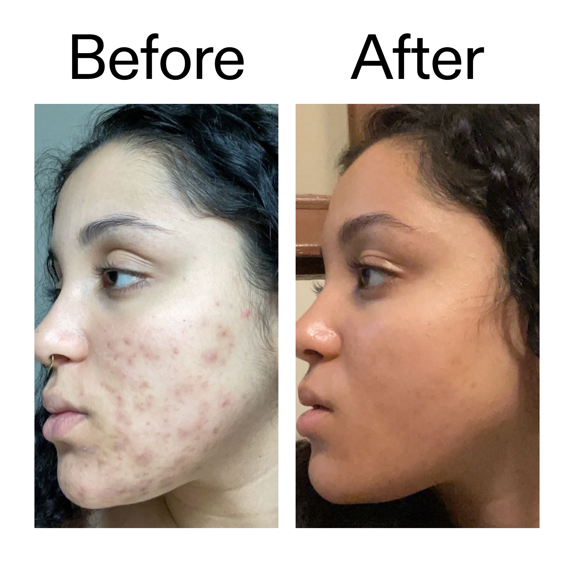 Tranexamic Acid Serum - Image 8