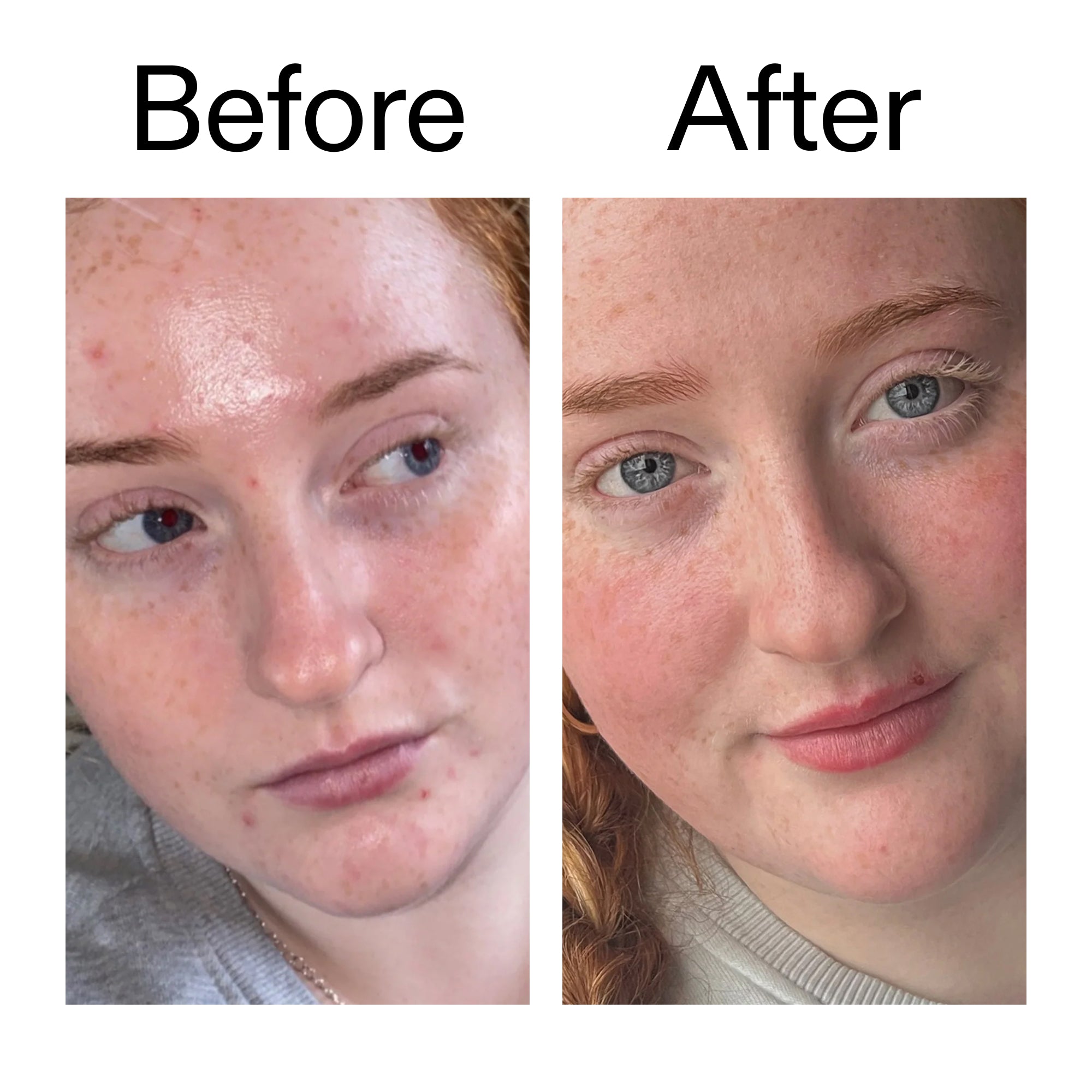 Vitamin B, C and E Moisturizer - Image 9